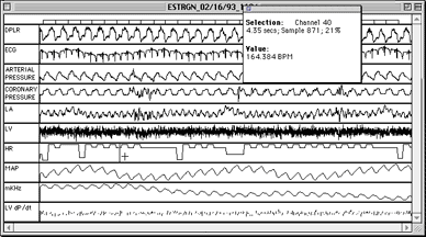 Picture10-orig-bpm-sm.gif