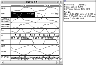 Picture13-avg-cycles-sel-sm.gif