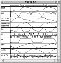 Picture8-avg-cycles-sm.gif